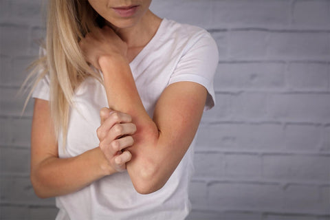 woman scratching harm needing eczema cream