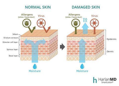 normal and damaged skin