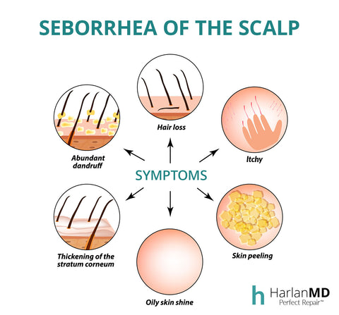 scalp eczema graphic