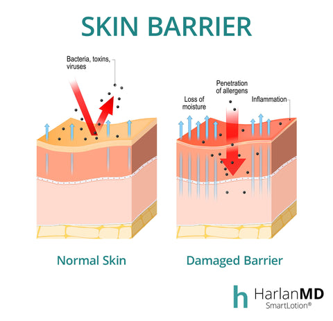 skin barrier