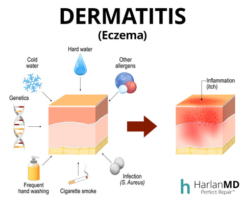 dermatitis explained