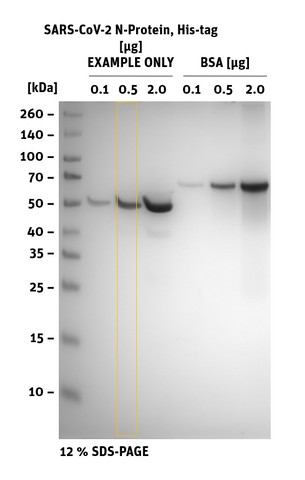 SDS-PAGE of SARS-CoV-2 (COVID-19) Nucleocapsid protein, His-Tag