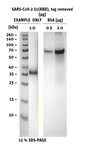 SARS-CoV-2 (COVID 19) Spike S1 Protein (RBD), Tag-removed SDS Page