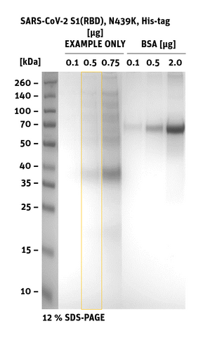 SARS-CoV-2 S1 (RBD) B.1.141/B.1.258 (Scotland/U.K.) SDS-Page