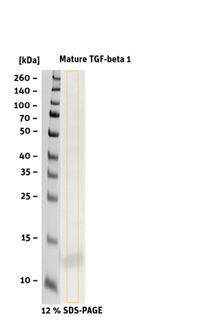 mature TGF-beta 1 sds page