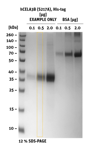 hCELA3B S217A His-tag sds-page