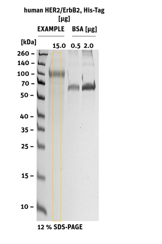 human HER2-ErbB2 SDS-page