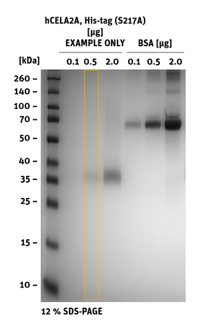 SDS-PAGE of hCELA23, His-Tag (S217A)