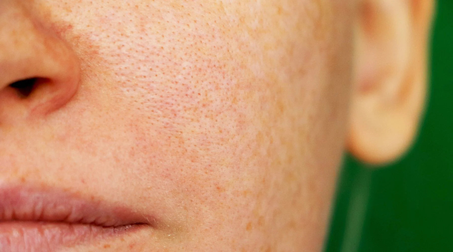 How To Shrink Large Pores