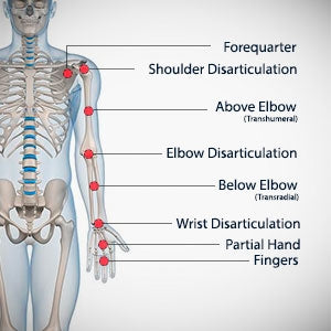 human physiology diagram depicting types of arm amputations