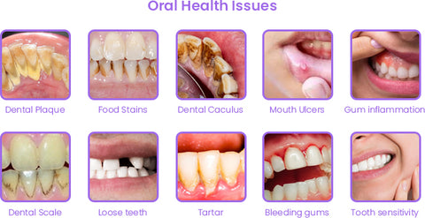 HerbalBrite™ Teeth Whitening Mousse