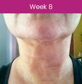 CollagenLUXE™ Hydrolyzed Collagen Neck Cream