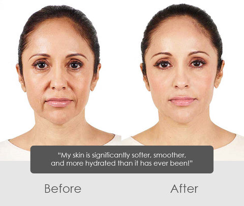 ChaffeeLife™ Wrinkle Reversing Botox Serum