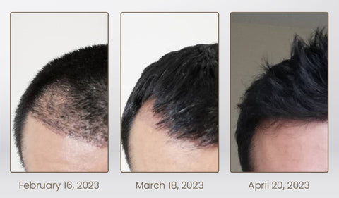 Ceoerty™ Hair Regrowth Treatment Spray