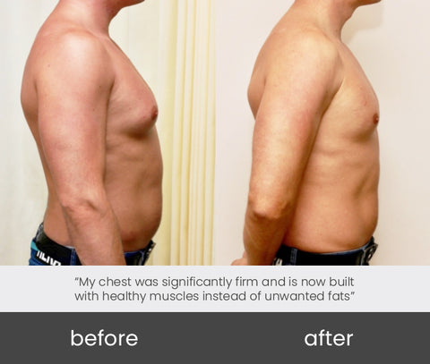 ChestFit™ Gynecomastia Heating Balm