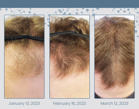 CC™ Root Renew Nourishing Hair Scrub