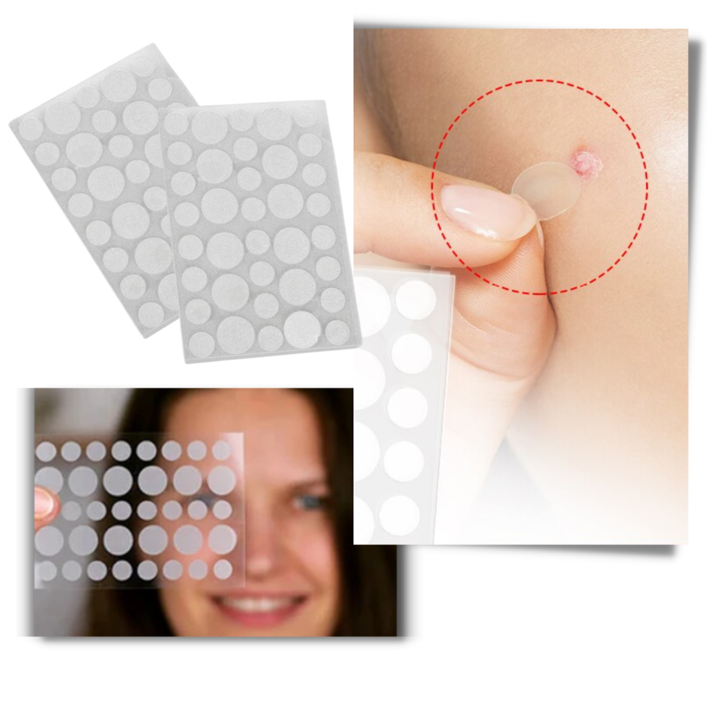 36-Pack Invisible Acne Patches - Invisible Patch - 