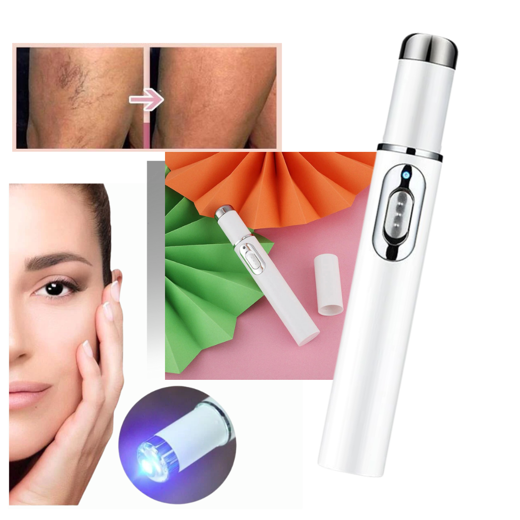 Blue Light Therapy Pen For Varicose And Spider Veins │Skin beauty tool - 