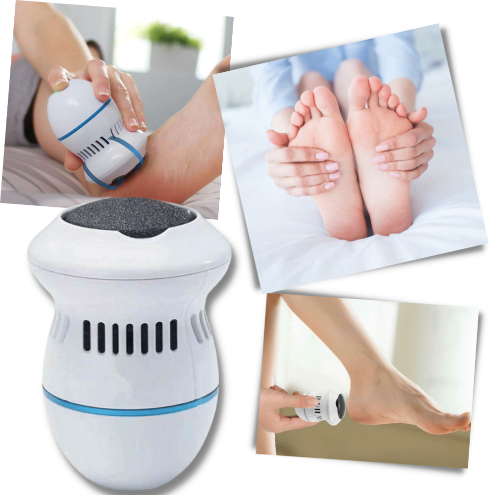 Appareil électrique pour enlever les callosités │ Ponceuse électrique de pieds │Outil de soins des pieds - Ozerty