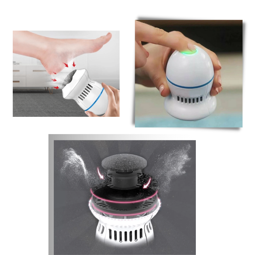 Electric Callus Remover - Double Gear Speed Regulation - 