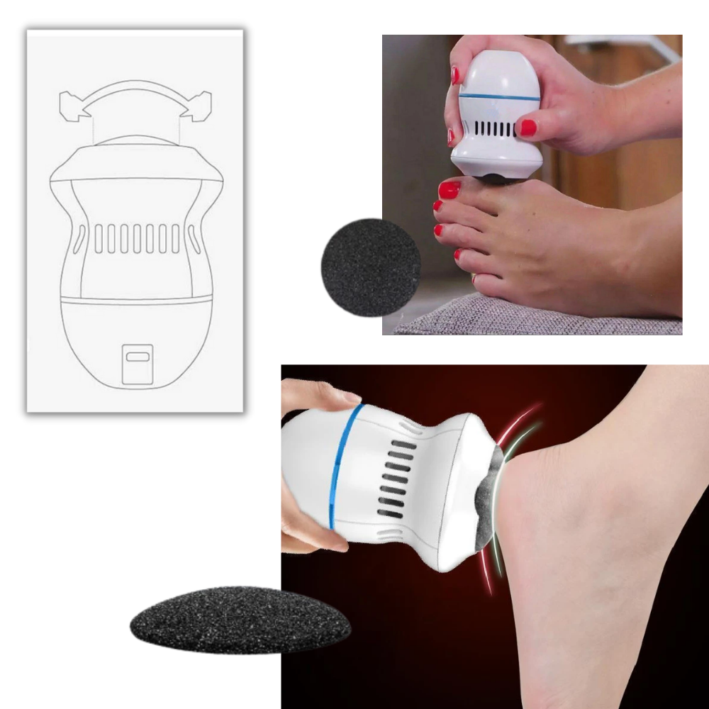 Electric Callus Remover - Two Types of Grinding Head - 