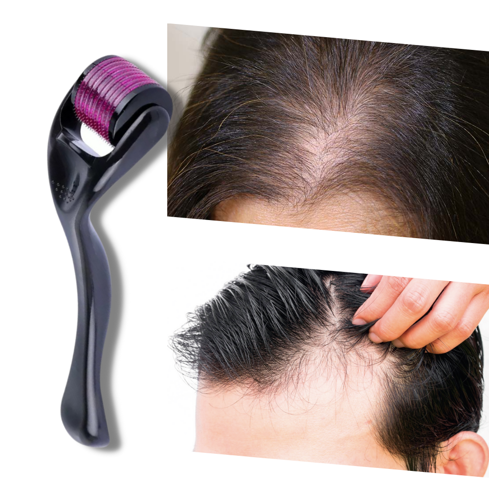 Rouleau dermique pour la croissance des cheveux et de la barbe - Rouleau dermique pour la peau - Ozerty