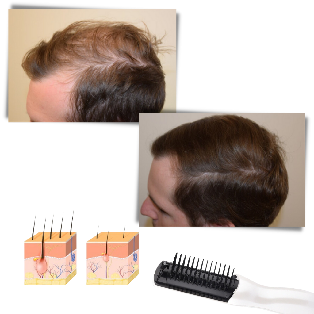 Peigne à laser infrarouge - Peigne à laser pour la croissance des cheveux - Ozerty