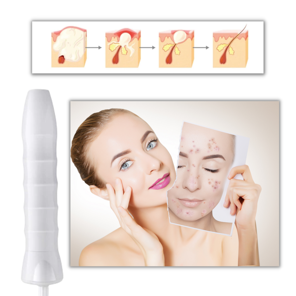 Anti-ageing skin light therapy device - Versatile uses -