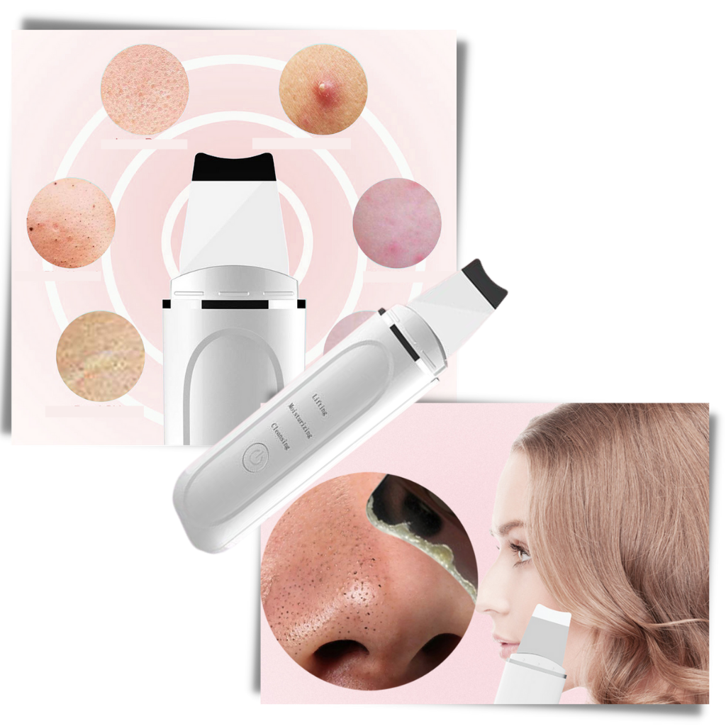 Ultrasonic deep cleansing facial scrubber - Electric skin spatula - 