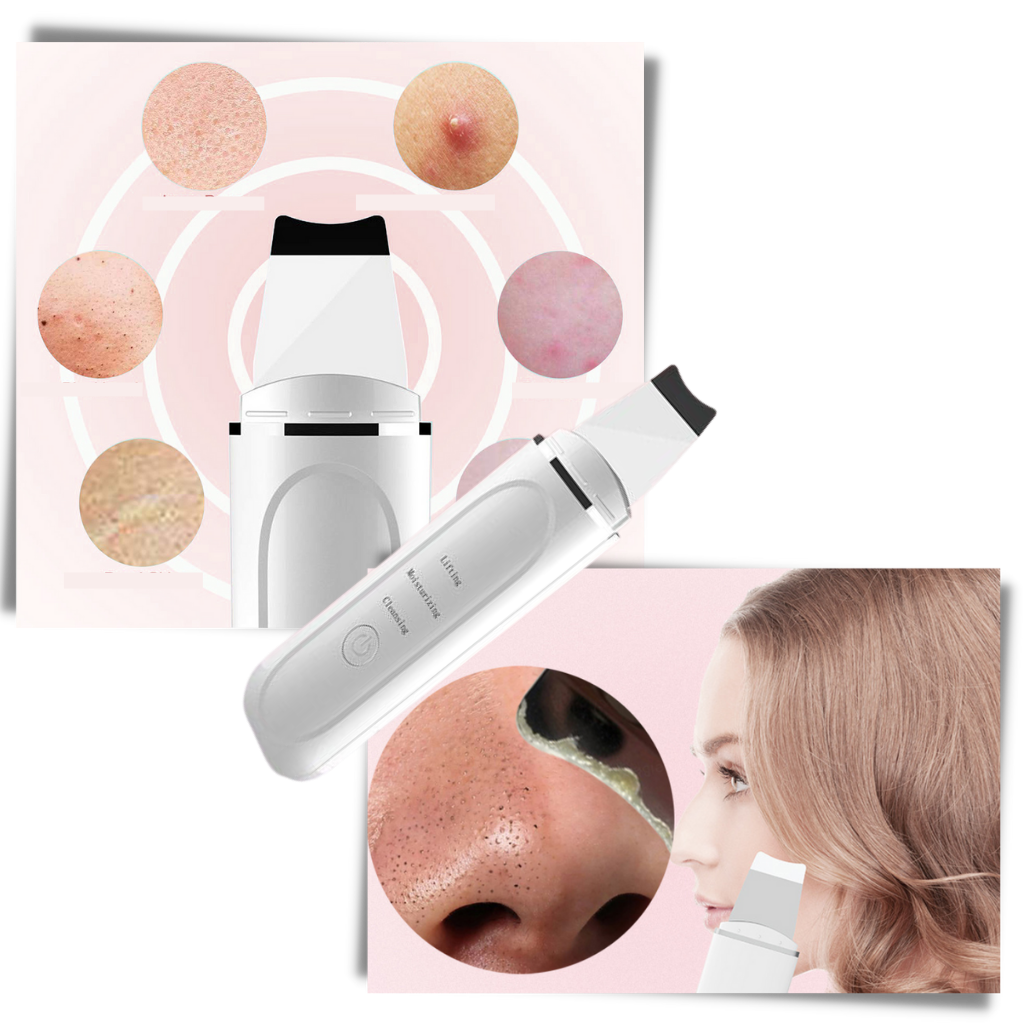 Spatule exfoliante ultrasonique pour le visage - Spatule électrique pour la peau - Ozerty