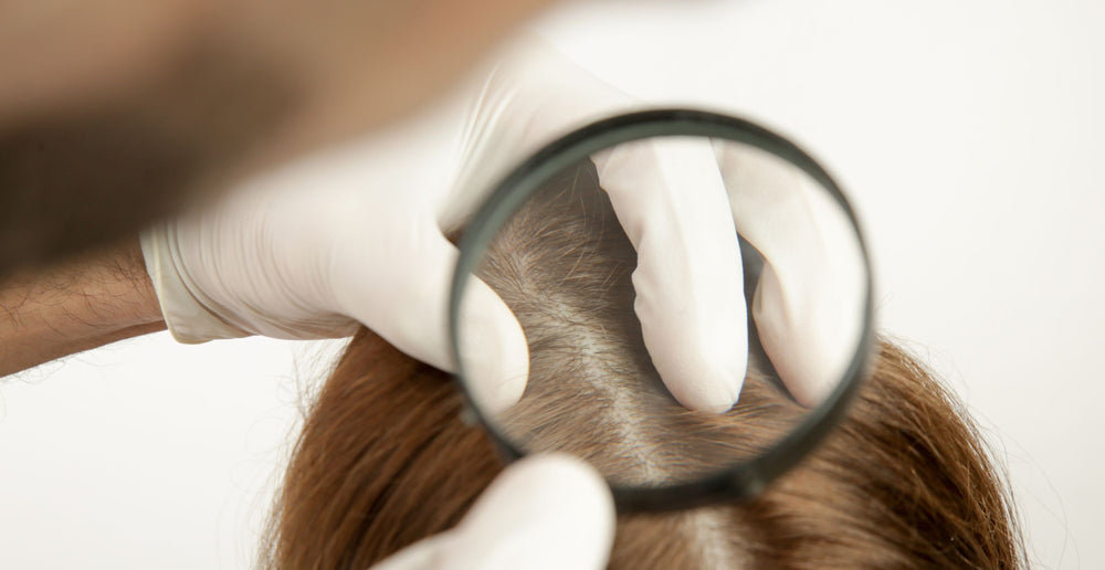 Pimples On The Scalp Why How Treatments  Common Myths  SkinKraft
