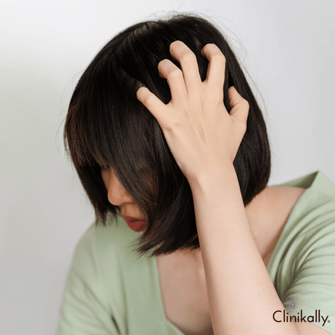 Symptoms of itchy scalp and dandruff