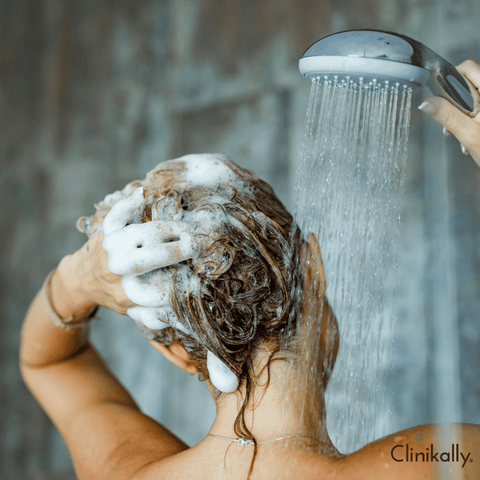 Long-term strategies for dandruff management