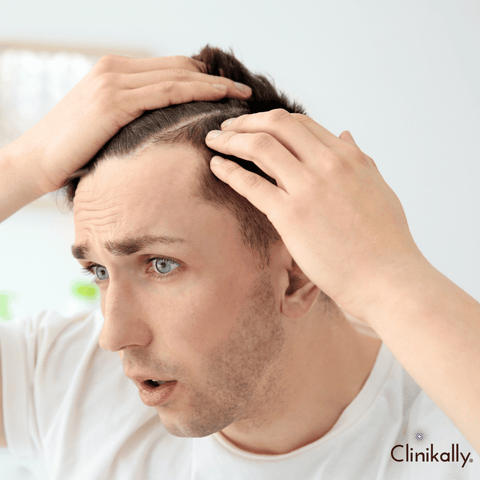 Harmful hair care ingredients for men