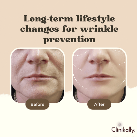 How to Prevent Wrinkles: Long-Term Healthy Skin Tips - LPG® America