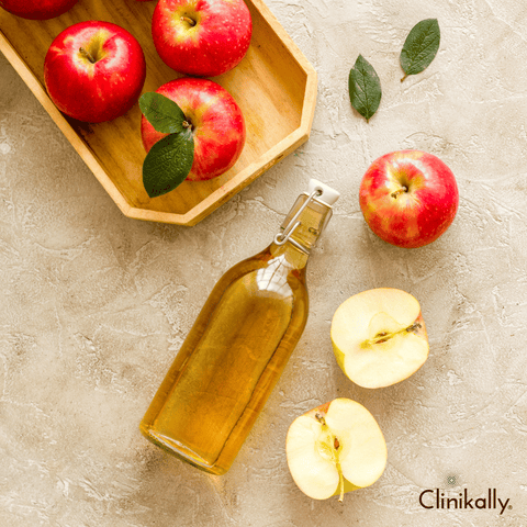 #3 Apply apple cider vinegar