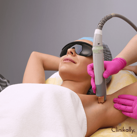 Laser therapy for underarm lightening