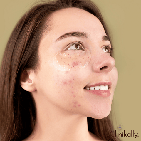 Addressing specific skin issues before the big day