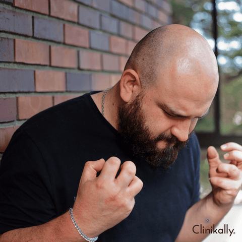 The Psychological Impact of Male Pattern Baldness