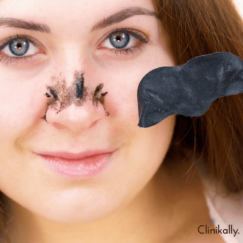 Environmental factors contributing to clogged pores