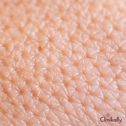 Pores and Sebum: The Culprits Behind Strawberry Skin