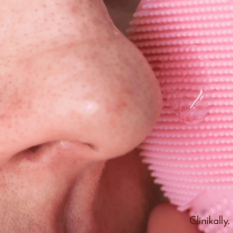 How to clear open pores on nose
