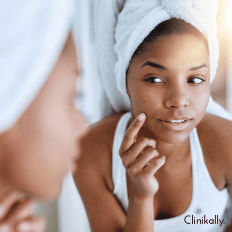 Daily skincare routines after chicken pox