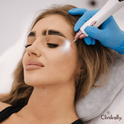 Microdermabrasion and Microneedling