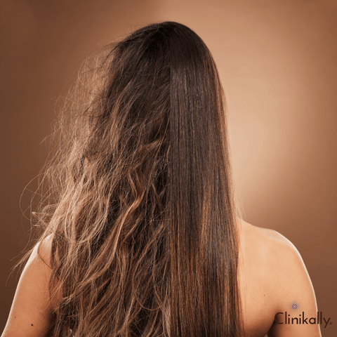 The relationship between hair type and split ends