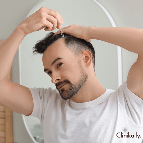 Minoxidil for hair growth: Benefits and uses