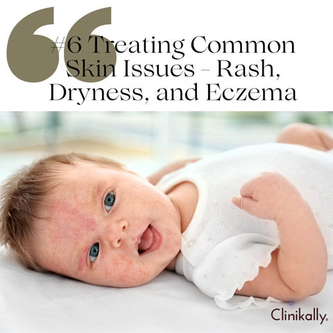 #6 Treating Common Skin Issues - Rash, Dryness, and Eczema