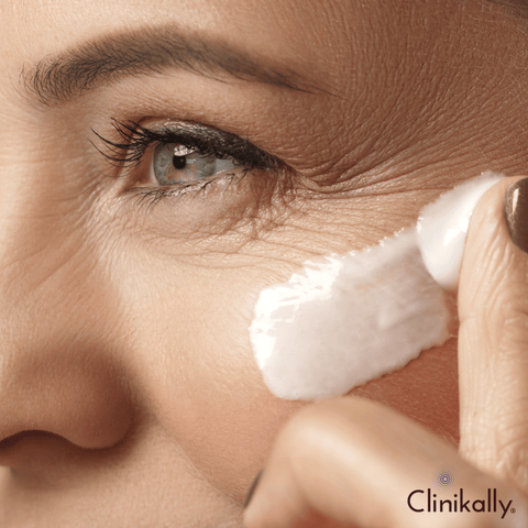 Fine Lines and Wrinkles: Causes and How to Treat