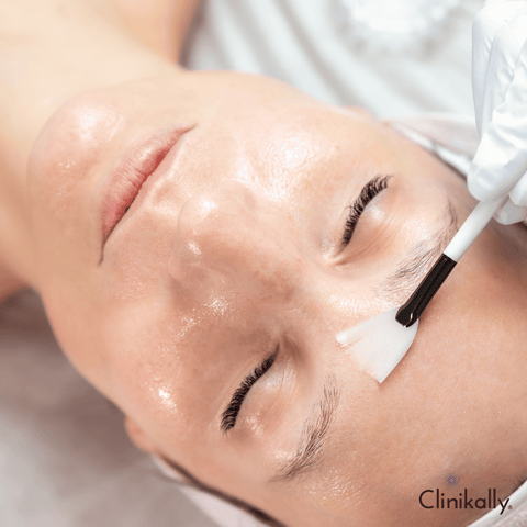Chemical peels and their effectiveness
