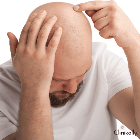 Understanding patchy vs total hair loss in Alopecia